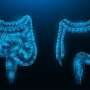 Combo therapy boosts survival for advanced colon cancer