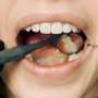 Healthy teeth are wondrous and priceless: Dentist explains why and how best to protect them