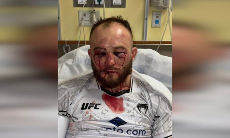 Photo: Mateusz Rebecki reveals horrifying facial damage from brutal UFC on ESPN 56 loss