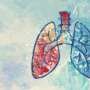 Study shows ivonescimab improves progression-free survival in EGFR+ lung cancer