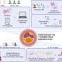 Study identifies molecular profile of rheumatoid arthritis patients with increased cardiovascular risk