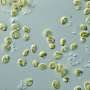 Microrobots made of algae carry chemo directly to lung tumors, improving cancer treatment
