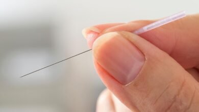 Acupuncture Reduced Hot Flashes Related to Endocrine Therapy for Breast Cancer