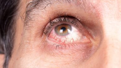 Novel JAK1 Inhibitor Reduced Treatment Failures in Active Noninfectious Uveitis