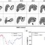 Combination drug strategy produces promising results by hyperactivating oncogenic signaling