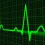 Atrial fibrillation estimated to be three times more common than previously thought