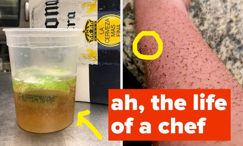 “It Just Burns Away From The Heat Of The Kitchen”: 14 Realities That Are “Typical” For A Chef That Baffle Will Most People