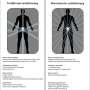 What is stereotactic radiation therapy for prostate cancer? How does it compare to other treatments?