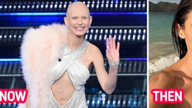 Victoria’s Secret Top Model Moves Everyone Showing Her Scar and Shaved Head at a Festival